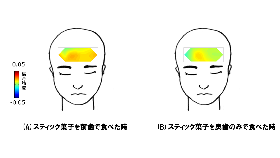 脳血流　ポッキー