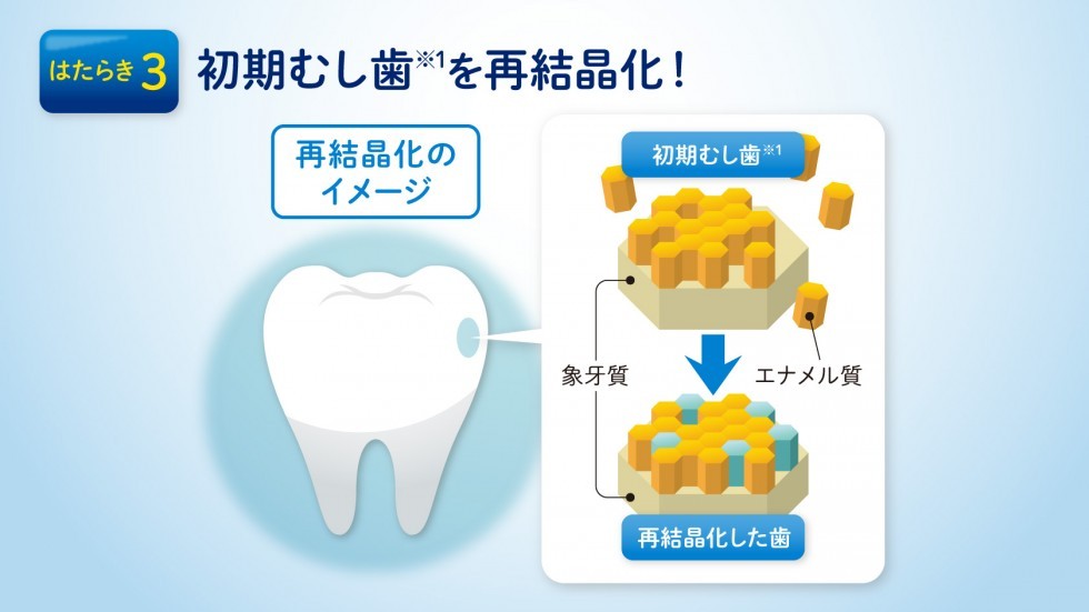 初期むし歯を再結晶化